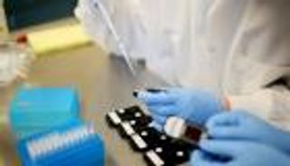 علماء يستخدمون الملاريا للكشف عن السرطان