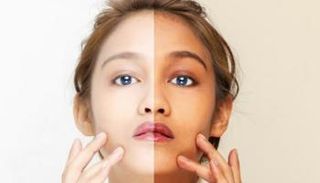 هناك طرق عديدة للتخلص من تان البشرة