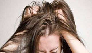 طرق طبيعية للتخلص من قشرة الشعر