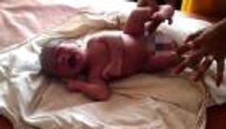 مولود بـ4 أرجل في الهند