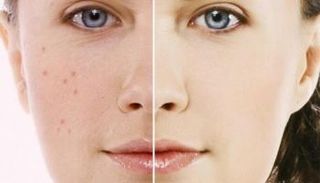 تطبيق يكشف عن مشكلات البشرة