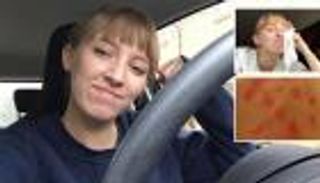 مرض نادر يمنع بريطانية من استخدام الماء في حياتها