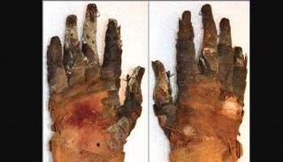 يد المومياء التي أجريت عليها الدراسة