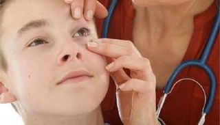 7 علامات تدل على الإصابة بالأنيميا - صورة أرشيفية