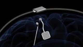 جهاز واند يساعد في علاج الاضطرابات العصبية