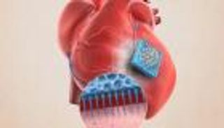 باحثون يطورون لاصقا طبيا لإعادة بناء أنسجة القلب