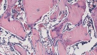 صورة توضح تشكل عظام الفئران بعد حقنها بالبروتين