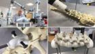 روبوت ينبئ بثورة في جراحة العمود الفقري