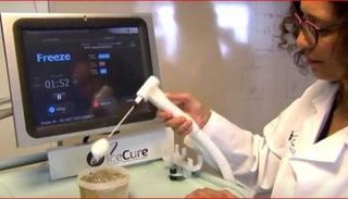 الإجراء الجديد يقوم بتجميد الأنسجة المستهدفة فقط