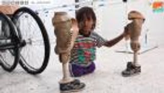 مركز الأطراف الصناعية بعدن.. ترميم ما شوهته ألغام الحوثي 