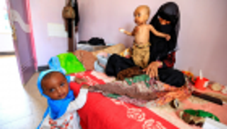 ثلث أطفال العالم يعانون سوء التغذية