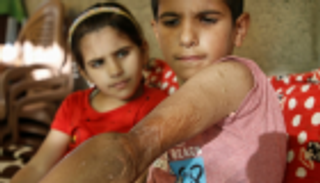 الطفل يامن.. "رجل غزة الحديدي" فقد أسرته خلال العدوان الإسرائيلي