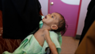 16 مليون طفل يعانون من سوء التغذية في 4 دول عربية