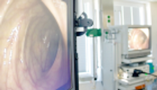 منظار المعدة يقي من سرطان القولون