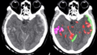 باستخدام الذكاء الاصطناعي.. تطوير تقنية جديدة تسهم في إنقاذ البشر