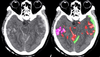 تقنية جديدة تسهم في إنقاذ البشر