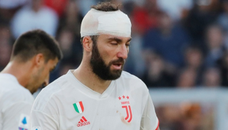 جونزالو هيجوايين مهاجم يوفنتوس