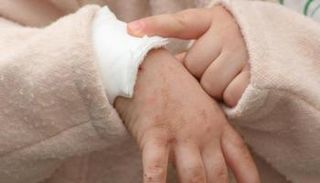 حوادث للأطفال خلال الأعياد