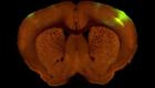 خريطة جديدة عالية الدقة لاتصالات الدماغ