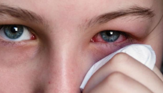 المواد الحافظة في القطرات قد تؤدي إلى تهيج العيون - أرشيفية