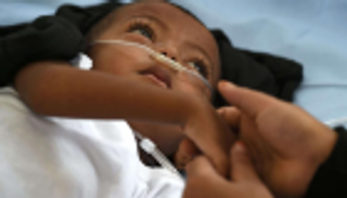 الالتهاب الرئوي يقتل طفلا كل 39 ثانية