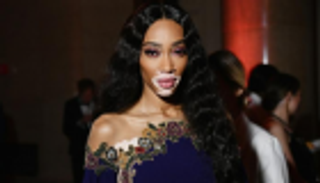 البهاق.. 5 حقائق عن المرض بعد إصابة رامي جمال