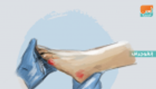 إنفوجراف.. 8 أعراض تنذر بـ"القدم السكرية"