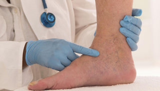 الاعتلال العصبي السكري من المضاعفات الخطيرة لمرض السكري