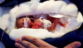 "تحيا مصر" يخصص 200 مليون جنيه لعلاج الأطفال المبتسرين