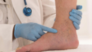 مشكلات الجلد قد تكشف الإصابة بالسكري