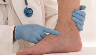 ينصح بضرورة استشارة الطبيب فور ملاحظة المشكلات الجلدية