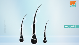 وقف تساقط الشعر أثناء الحمل