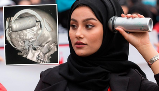 عبوات الغاز تخترق جماجم المتظاهرين العراقيين