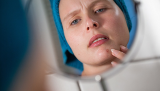 التوتر النفسي من أسباب إصابة البالغات بحب الشباب