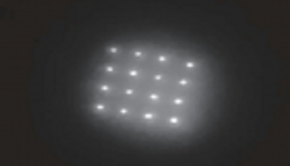 تخزين المعلومات الطبية تحت الجلد بالحقن