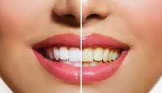 العناية بالأسنان تبدأ من اللثة