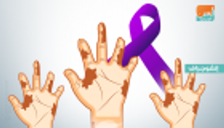 إنفوجراف.. اليوم العالمي لمرض الجذام