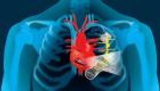 جهاز لتنظيم القلب يشحن نفسه بنبضات المريض