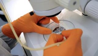 نمو كلى مزروعة في جرذان يعطي أملاً لزراعة الأعضاء لدى البشر - أرشيفية