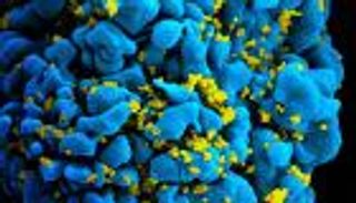 تقنية دقيقة لقياس إنتاج "الخزان الكامن" لفيروس الإيدز