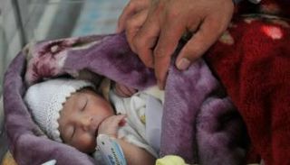 برنامج الذكاء الاصطناعي يشخص أمراض الأطفال - صورة أرشيفية