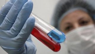 تركيبة دواء جديدة تعالج سرطان الكلى المتقدم - أرشيفية