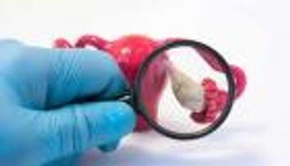 برنامج يعتمد على الذكاء الاصطناعي في تشخيص سرطان المبيض