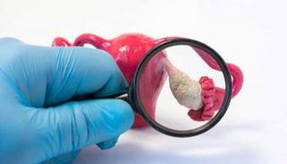 برنامج يعتمد على الذكاء الاصطناعي في تشخيص سرطان المبيض- صورة أرشيفية