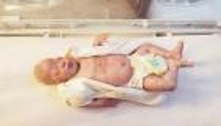 مجسّات لاسلكية تسهّل رعاية المواليد في المستشفيات