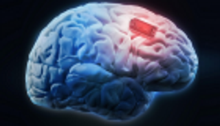 رقائق بالمخ لتعزيز الذكاء البشري خلال 5 سنوات