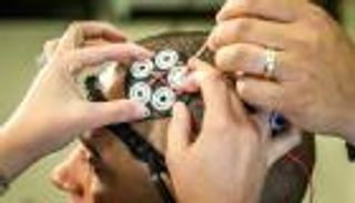 علاج جديد للاكتئاب.. صعقات كهربائية في الرأس