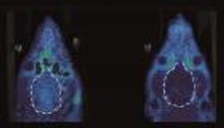 دراسة أمريكية تتوصل لبديل آمن للأفيون 