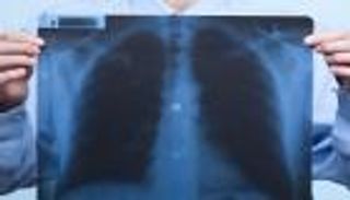 المؤتمر العالمي الثامن لطب الأشعة يوصي بالاعتماد على الذكاء الاصطناعي