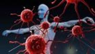 مرض الكلى المزمن يقود للإصابة بالسرطان